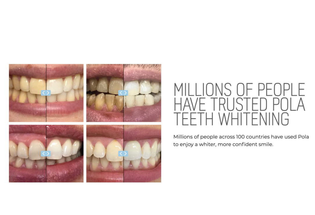 Pola Day 6% Hydrogen Peroxide Teeth Whitening Bleaching Gel 3gramx4 and 3xtrays | Shade Guide and Instructions